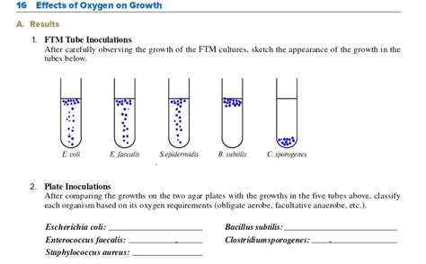 FTM Tube 